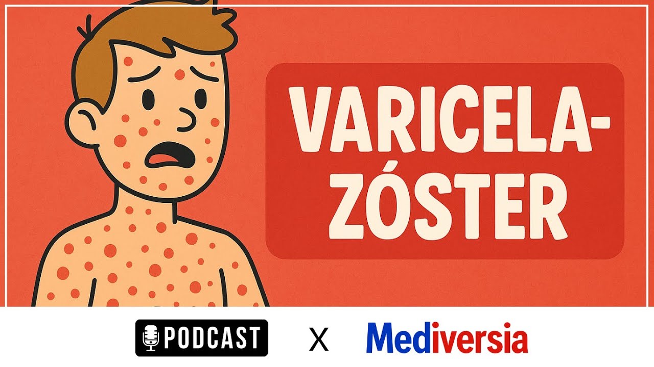 Virus Varicela-Zóster - diagnóstico, fisiopatología, clínica y tratamiento | Podcast |