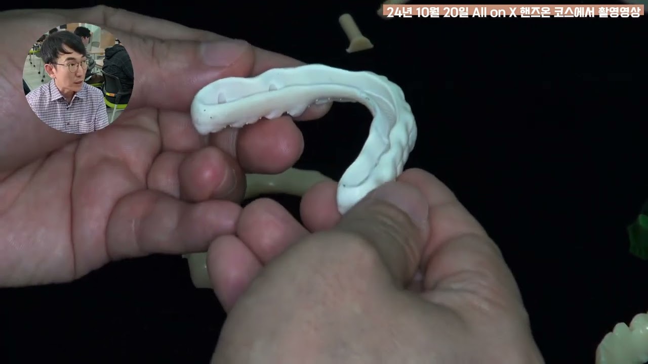 김경진소장의 b4d을 이용한 보철작품보기