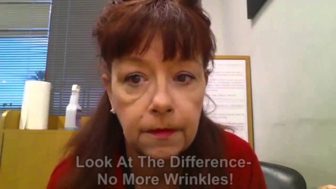 90 Second Wrinkle Eraser LIVE DEMO