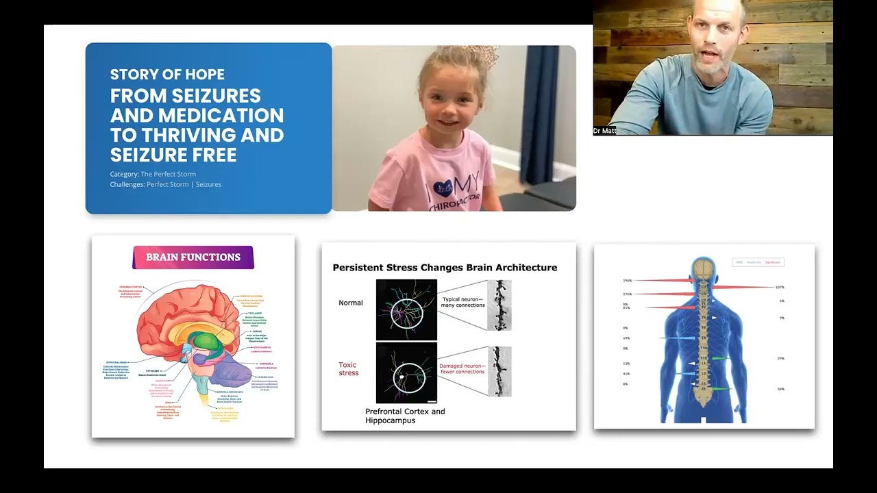 The Science Behind Seizures