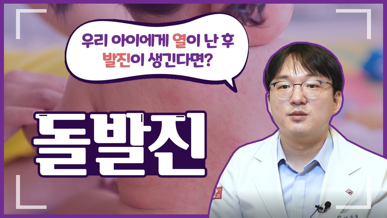 고열이 증상인 돌발진, 코로나 바이러스와 다른 점은?