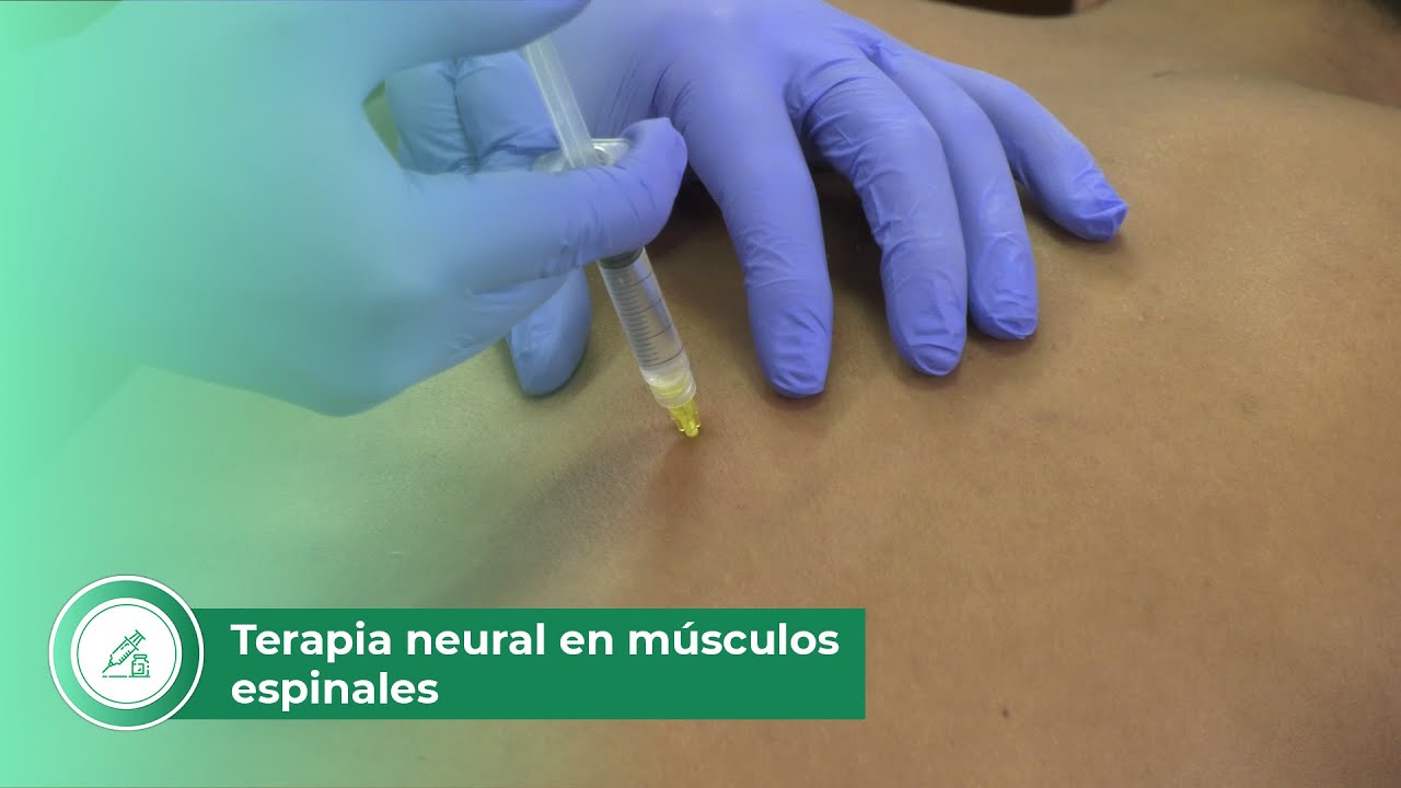 Terapia neural en m&uacute;sculos espinales