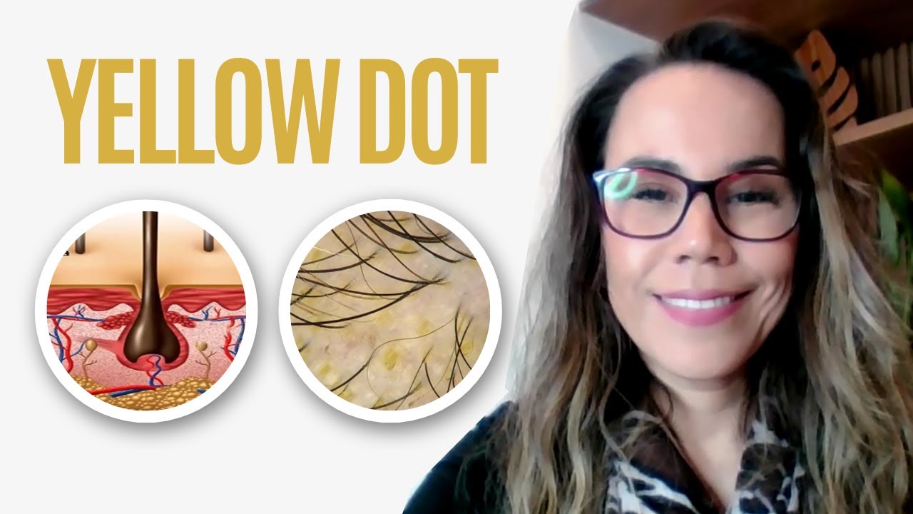 Yellow Dot