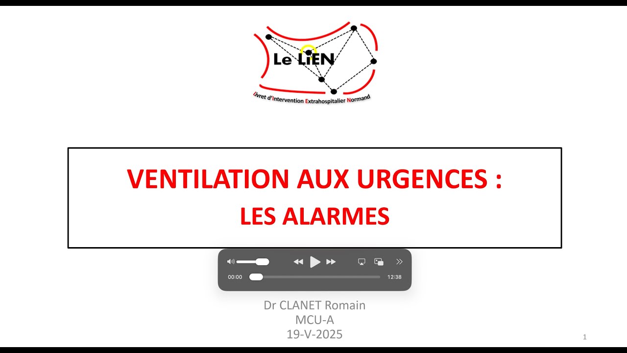 Ventilation aux urgences : Les alarmes