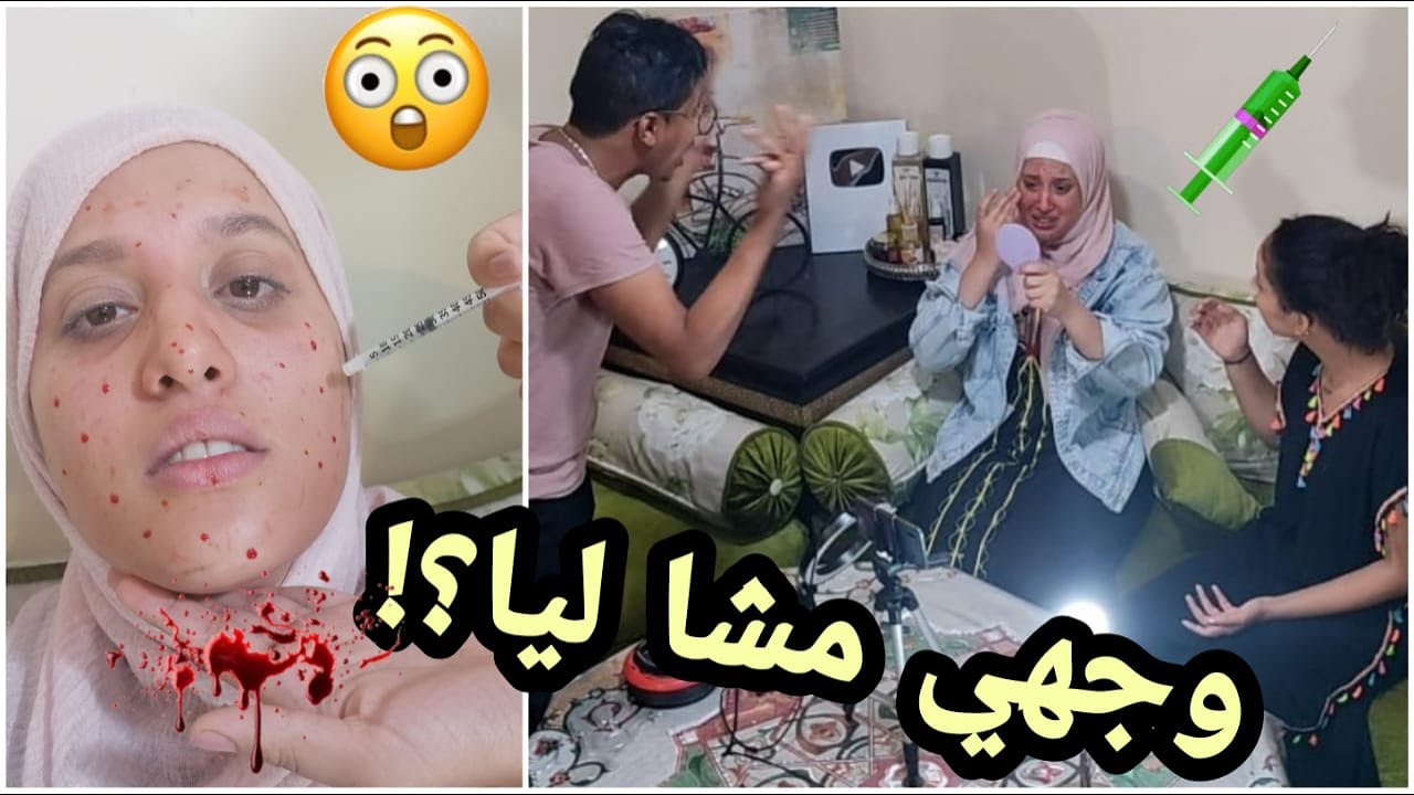 حقنات لوجهي بحقنة البوطوكس💉تشوه ليا وجهي😱بكيت او تعصب علينااا 😅مقلب في زوجي💯