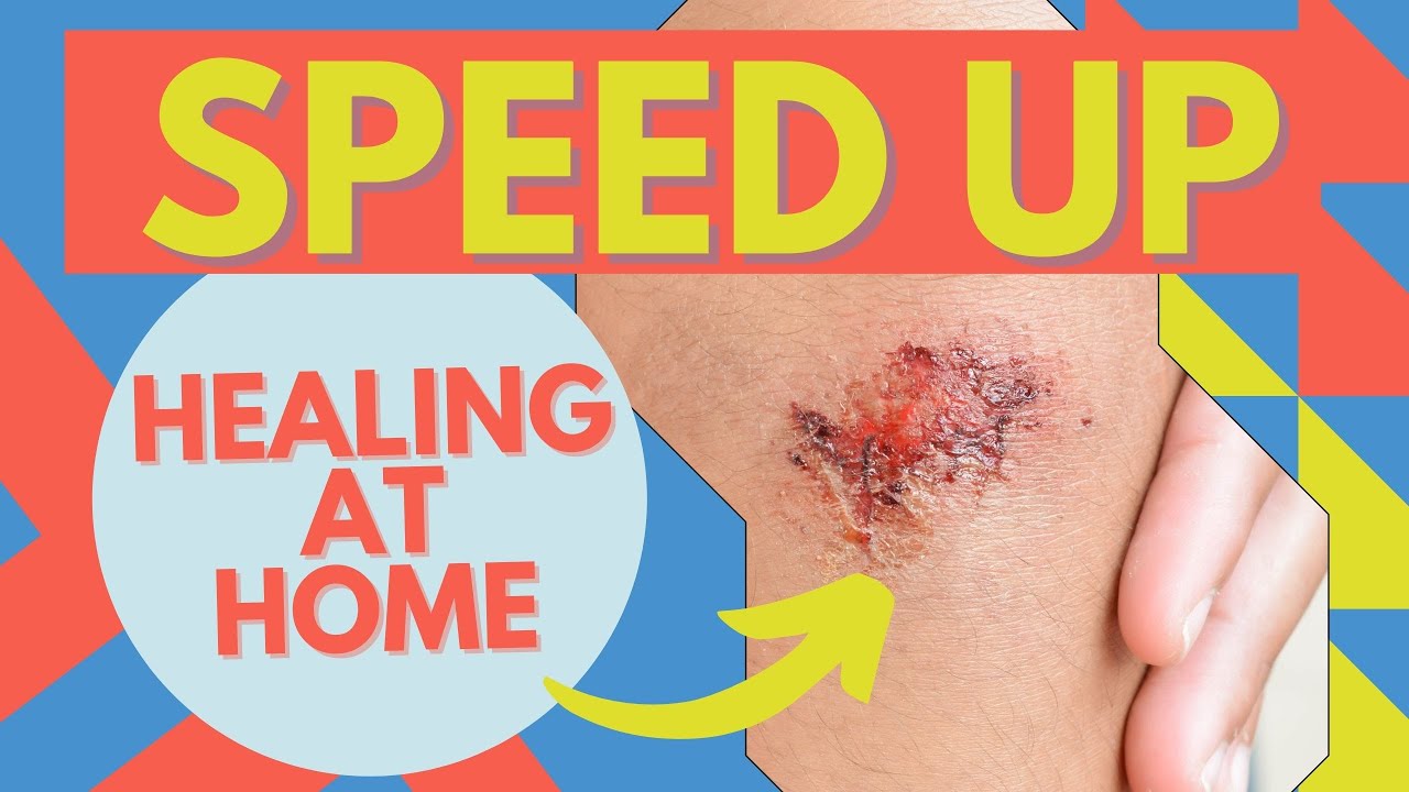 Wound Care! How To Heal Faster At Home