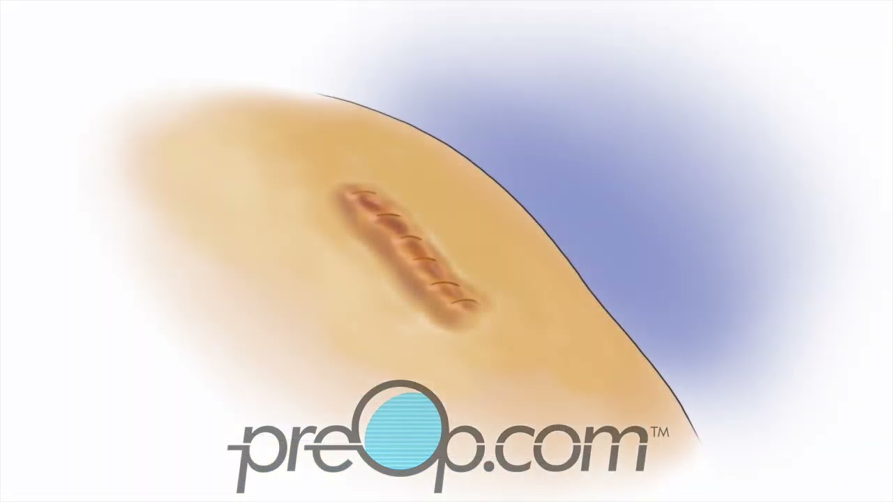 🩹🚑 Expert Wound Care Tips: Heal Faster & Safer 