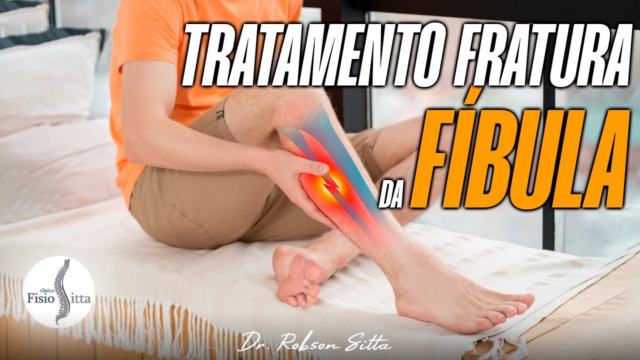 TRATAMENTO COMPLETO FRATURA FÍBULA - Clínica de Fisioterapia Dr. Robson Sitta