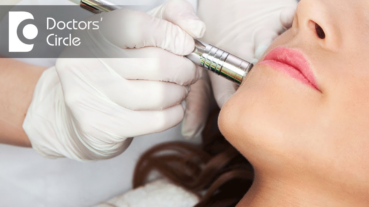 Will open pores shrink after Laser treatment? - Dr. Nischal K