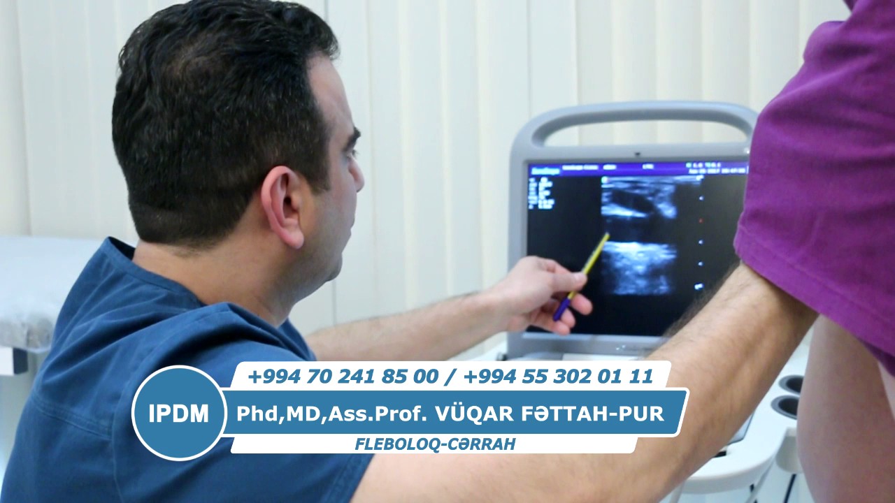 Varikozun yaranmasi nece bas verir - Dr. Vuqar Fettah-Pur Cerrah Fleboloq