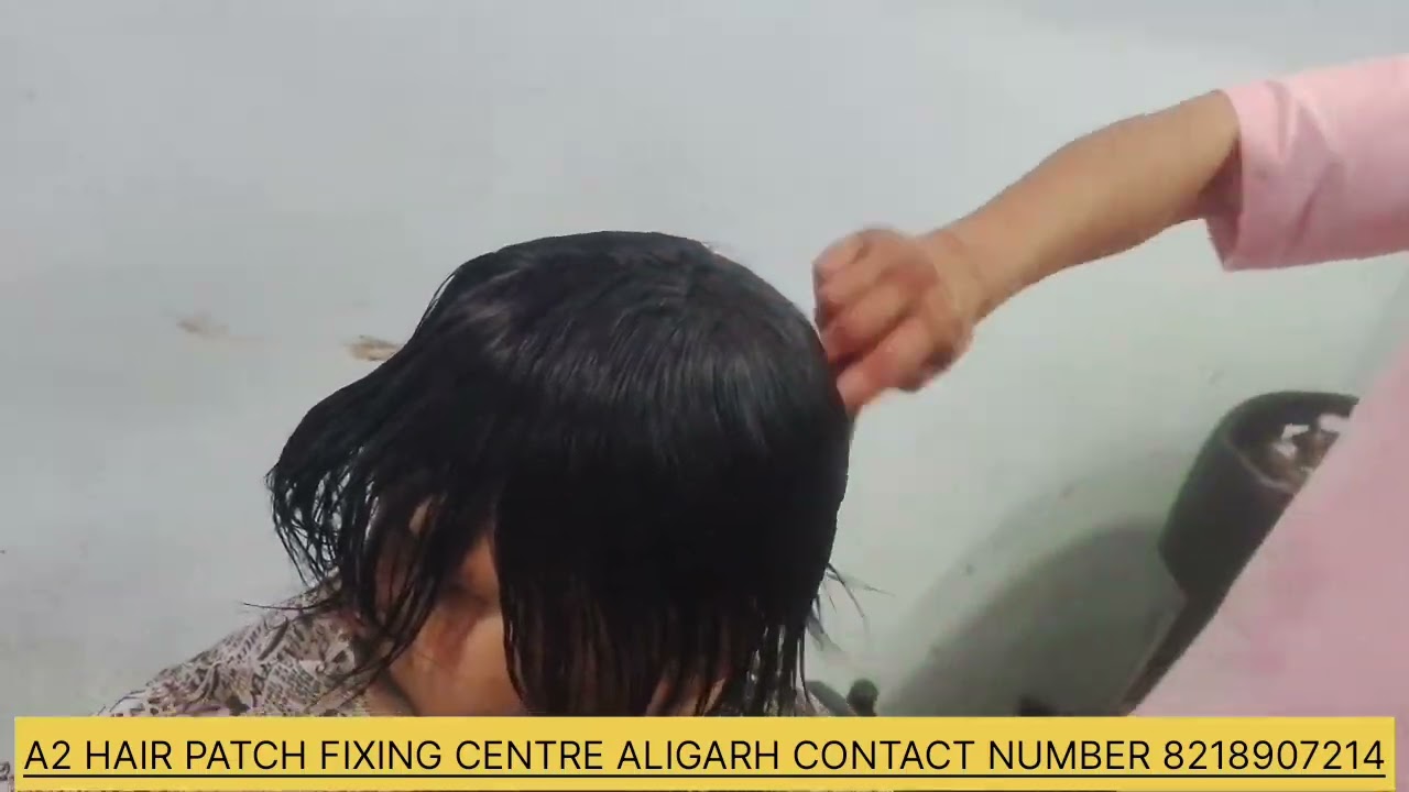 A2 HAIR PATCH FIXING CENTRE ALIGARH CALL 8218907214 HATHRAS MATHURA SIKANDRA RAO KASGANJ ETA KHURJA