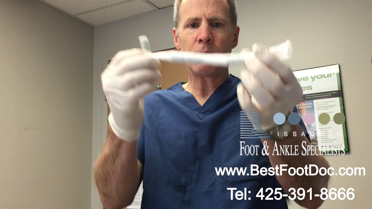 Crest Pad Treatment for Hammertoes