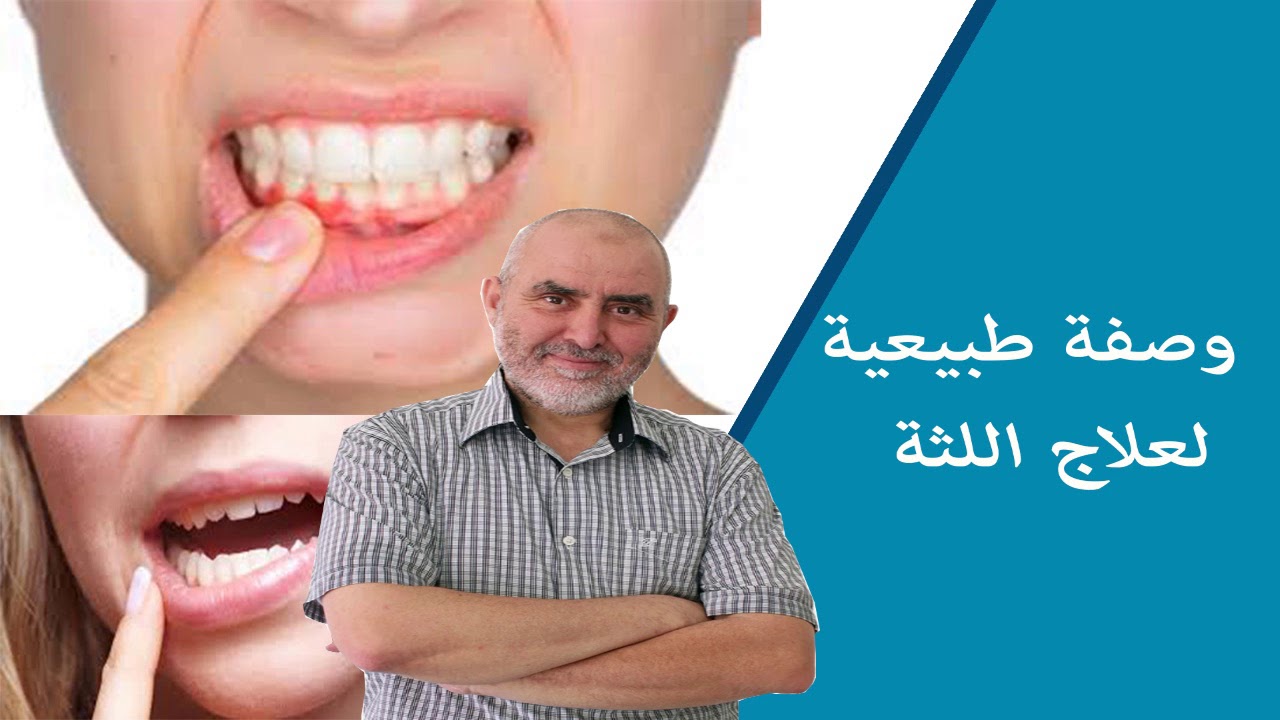 وصفة طبيعية لعلاج اللثة الدكتور عبد الكريم العابد العلوي