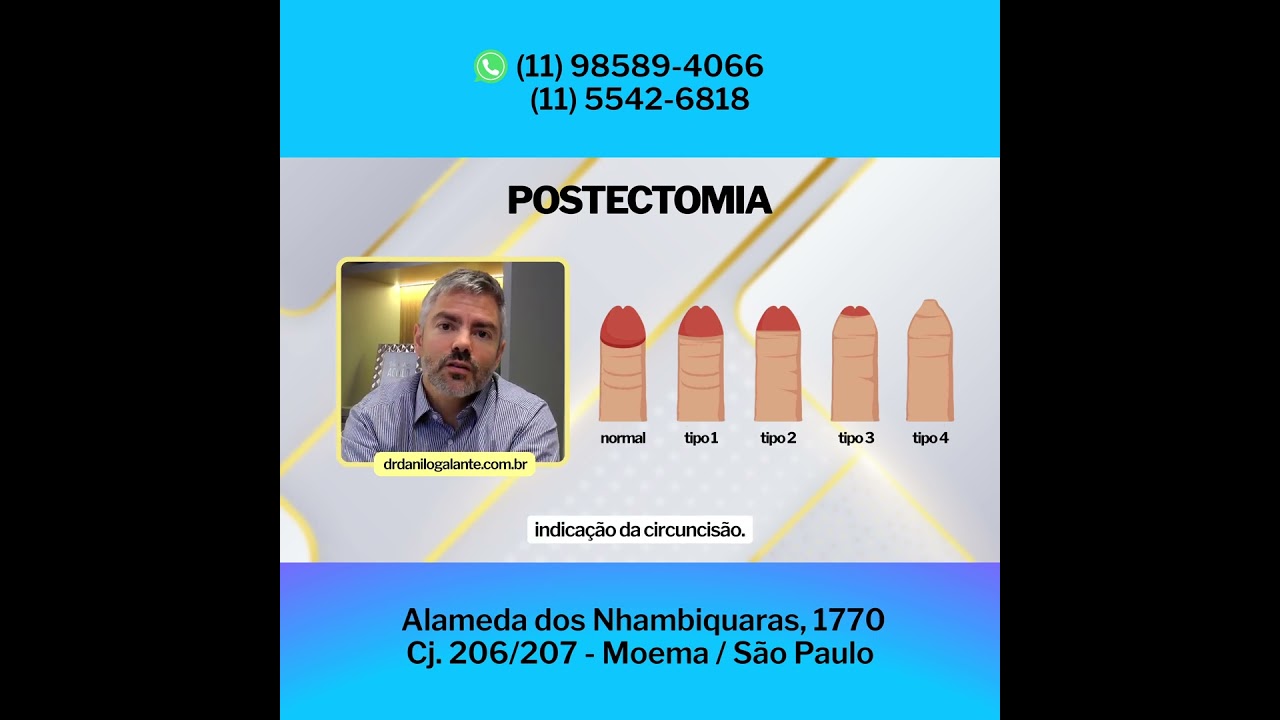 FIMOSE: cirurgia pra todos? #urologia #medicina #anestesia