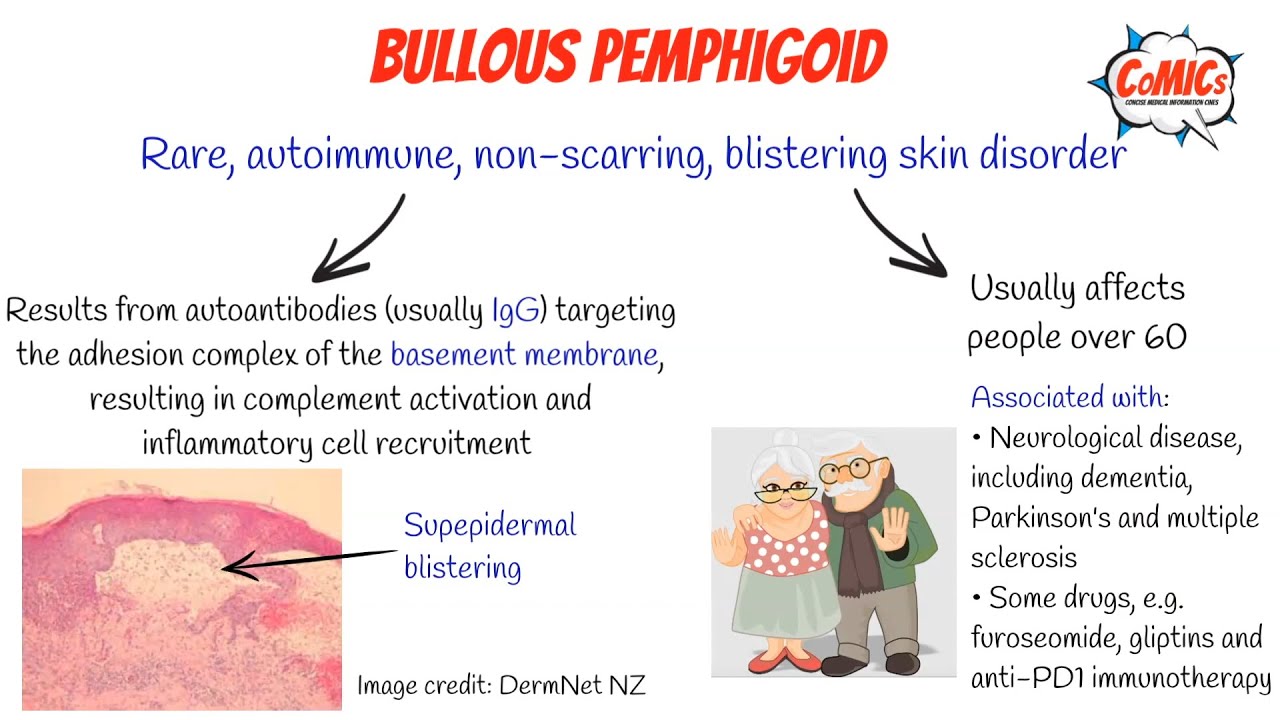 CoMICs Episode 58: Bullous pemphigoid