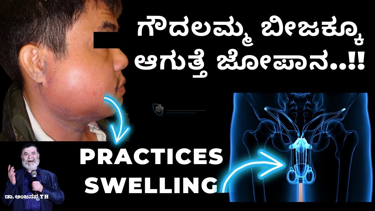ಗೌದಲಮ್ಮ ಬೀಜಕ್ಕೂ ಆಗುತ್ತೆ ಜೋಪಾನ..!! Practices Swelling