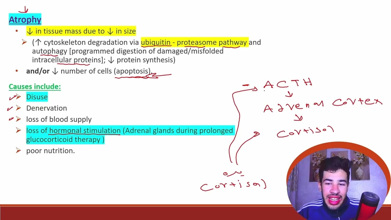 المحاضره الاولي من ال General pathology