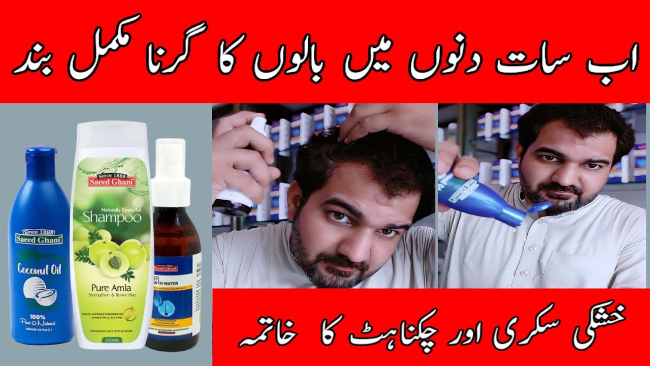 3 best things I recommend you to do to prevent hair loss Solution #hairloss #hairlosstreatment