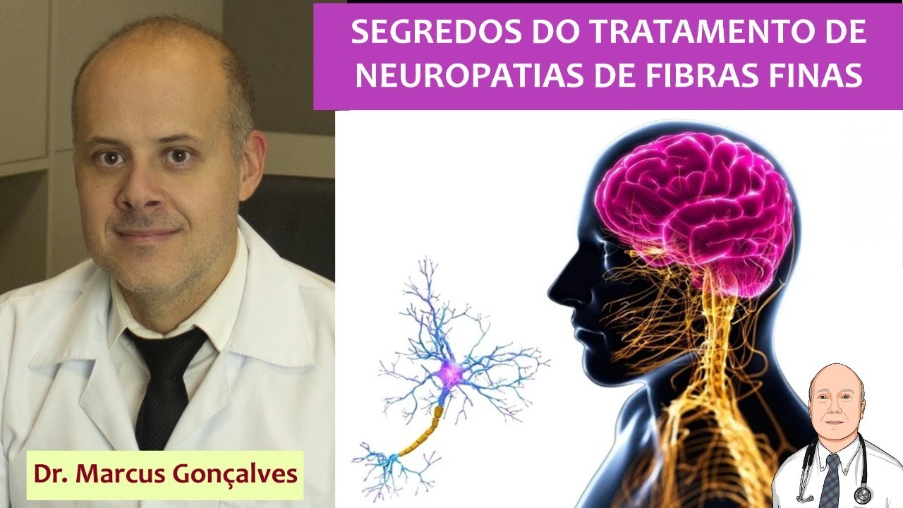 Tudo sobre o tratamento de neuropatias de fibras finas: resolvendo as causas e os melhores remédios