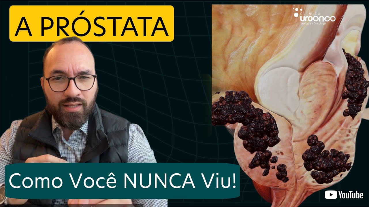O que nunca te mostraram sobre a próstata: a verdade em 3D