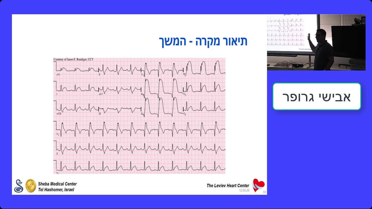 Acute heart failure- הגישה למטופל ב