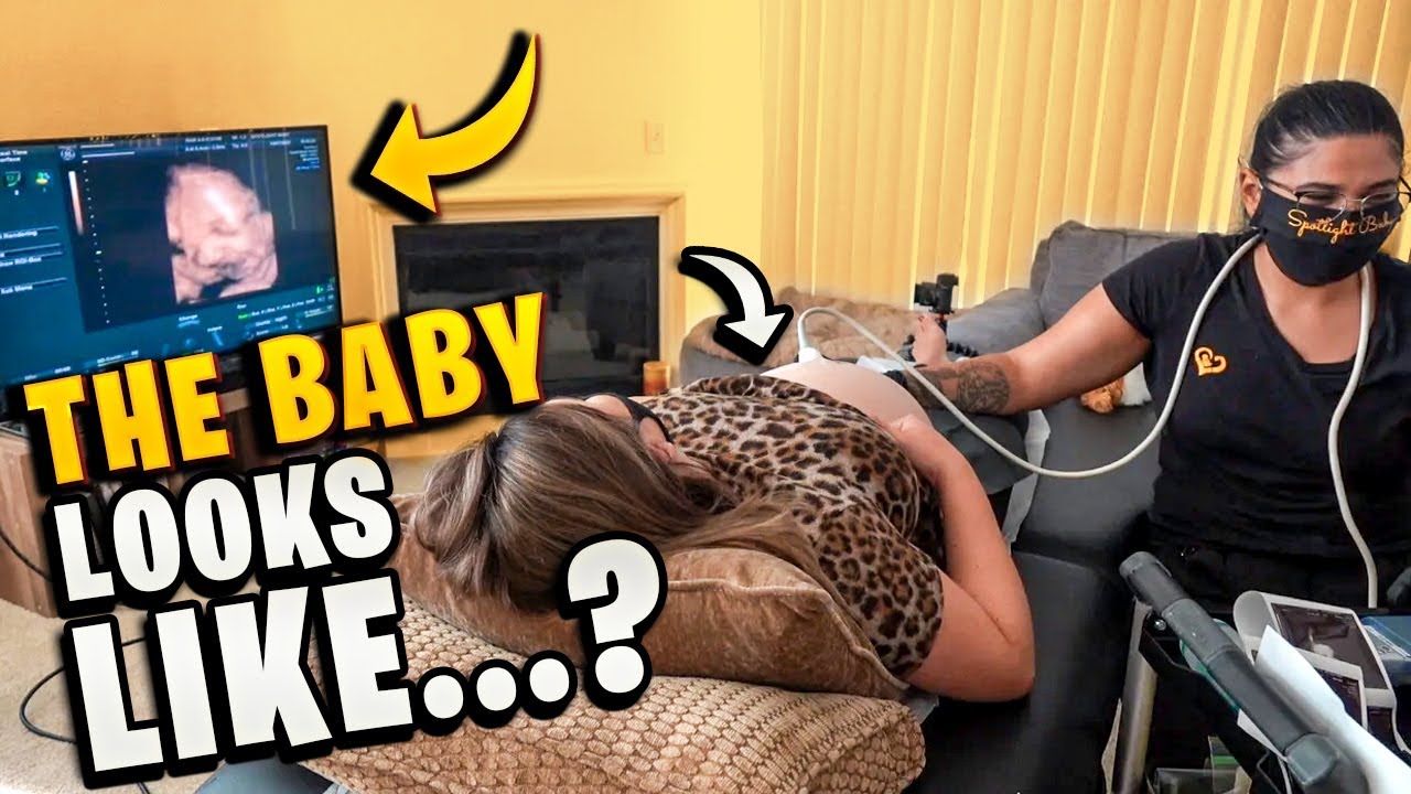 4D ULTRASOUND - 34 WEEKS PREGNANT