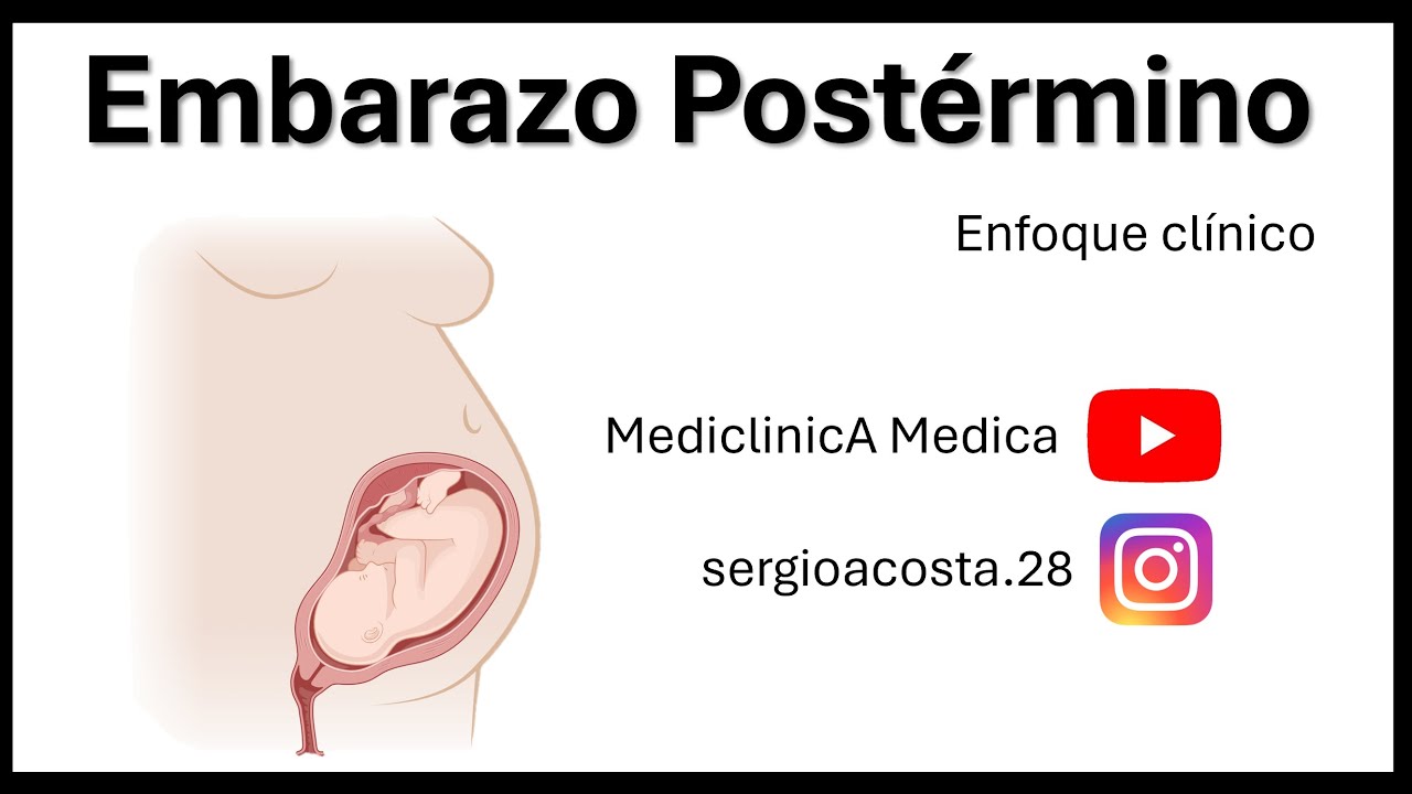 Embarazo Postérmino (Artículos novedosos recientes en la descripción)
