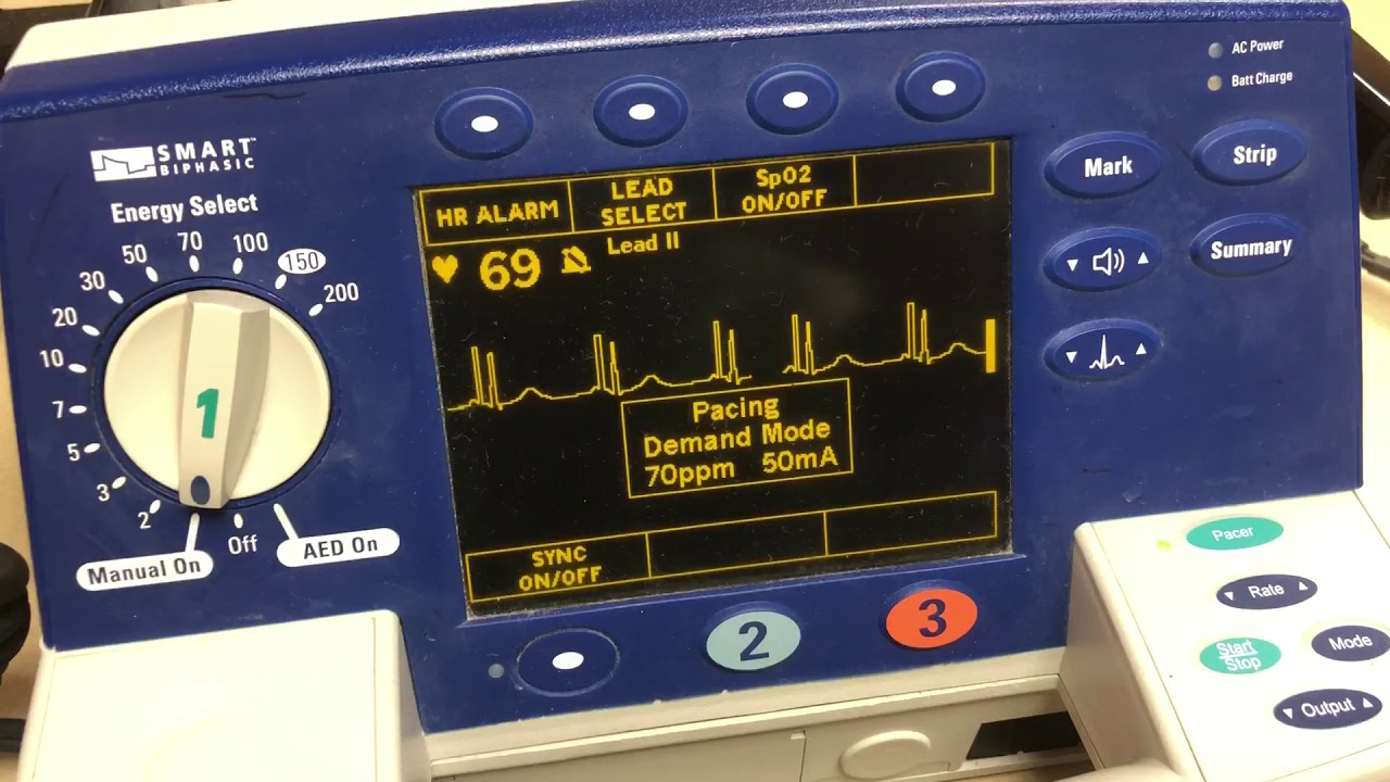 Trancutaneously pacing with the Phillips heart start monitor