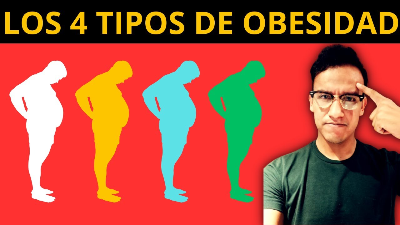 Los 4 TIPOS DE OBESIDAD: tratamiento personalizado