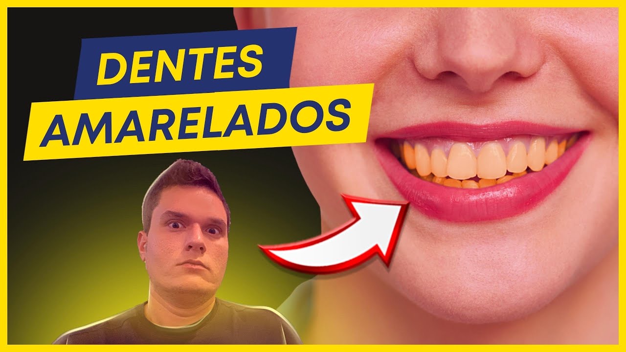 A VERDADE SOBRE DENTES AMARELADOS | CAUSAS E TRATAMENTO.