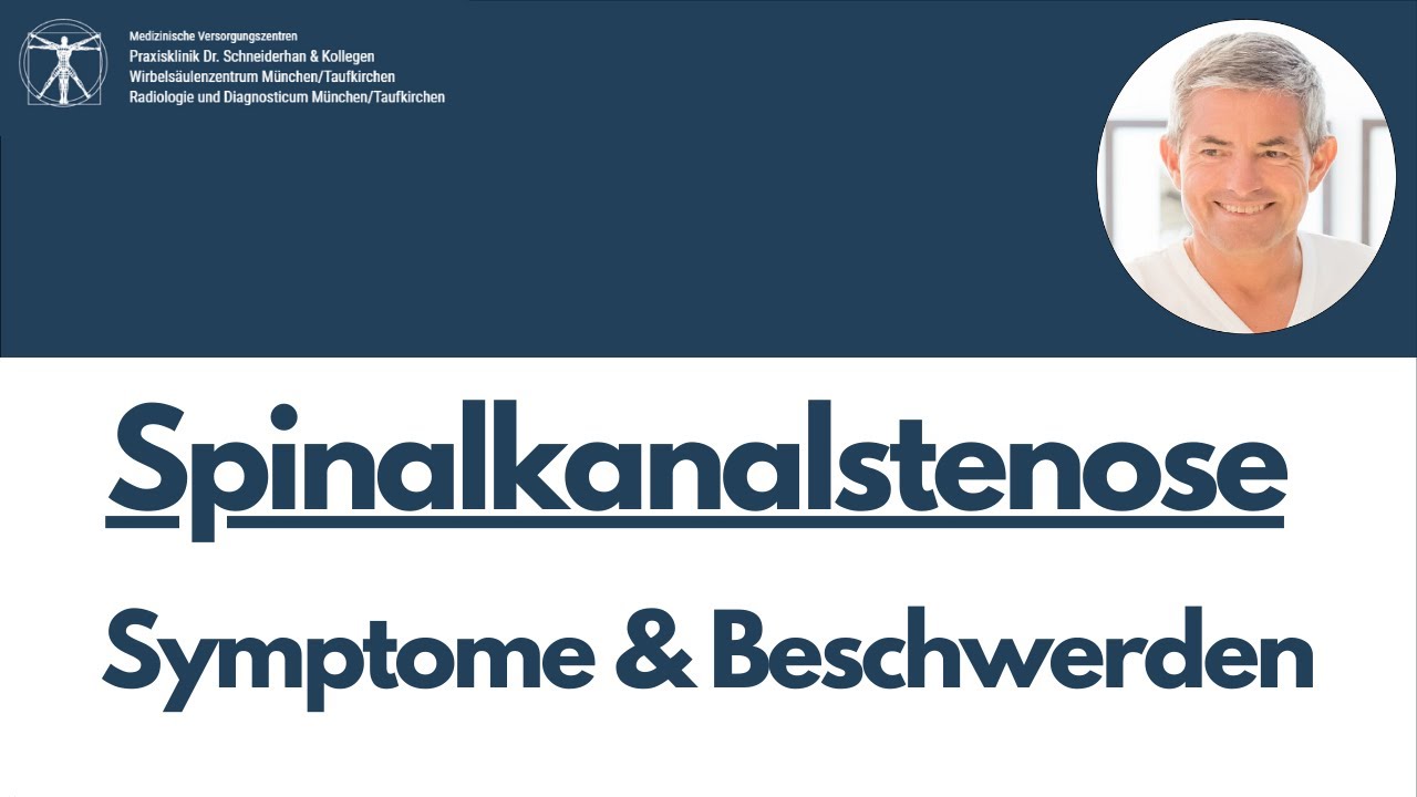 Spinalkanalstenose - Typische Symptome - Kurz erklärt Teil 1/3