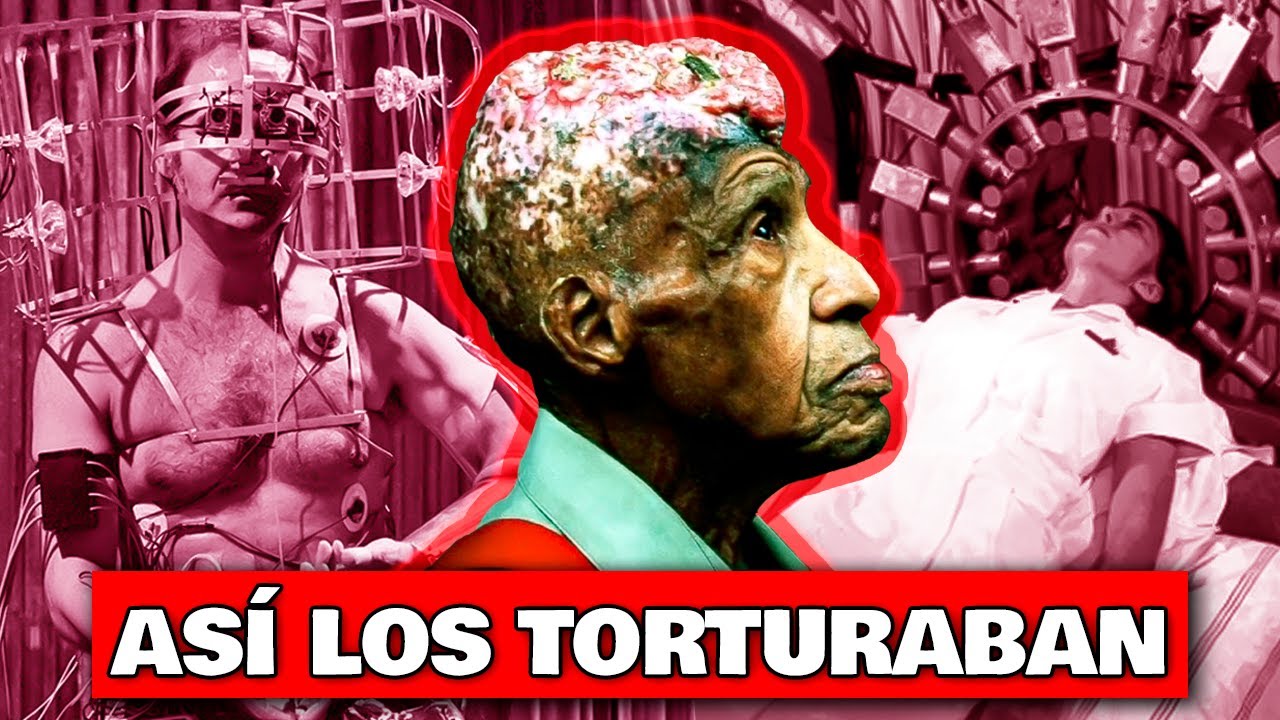 Los más TERRIBLES EXPERIMENTOS en HUMANOS de la HISTORIA - TOP TORTURA