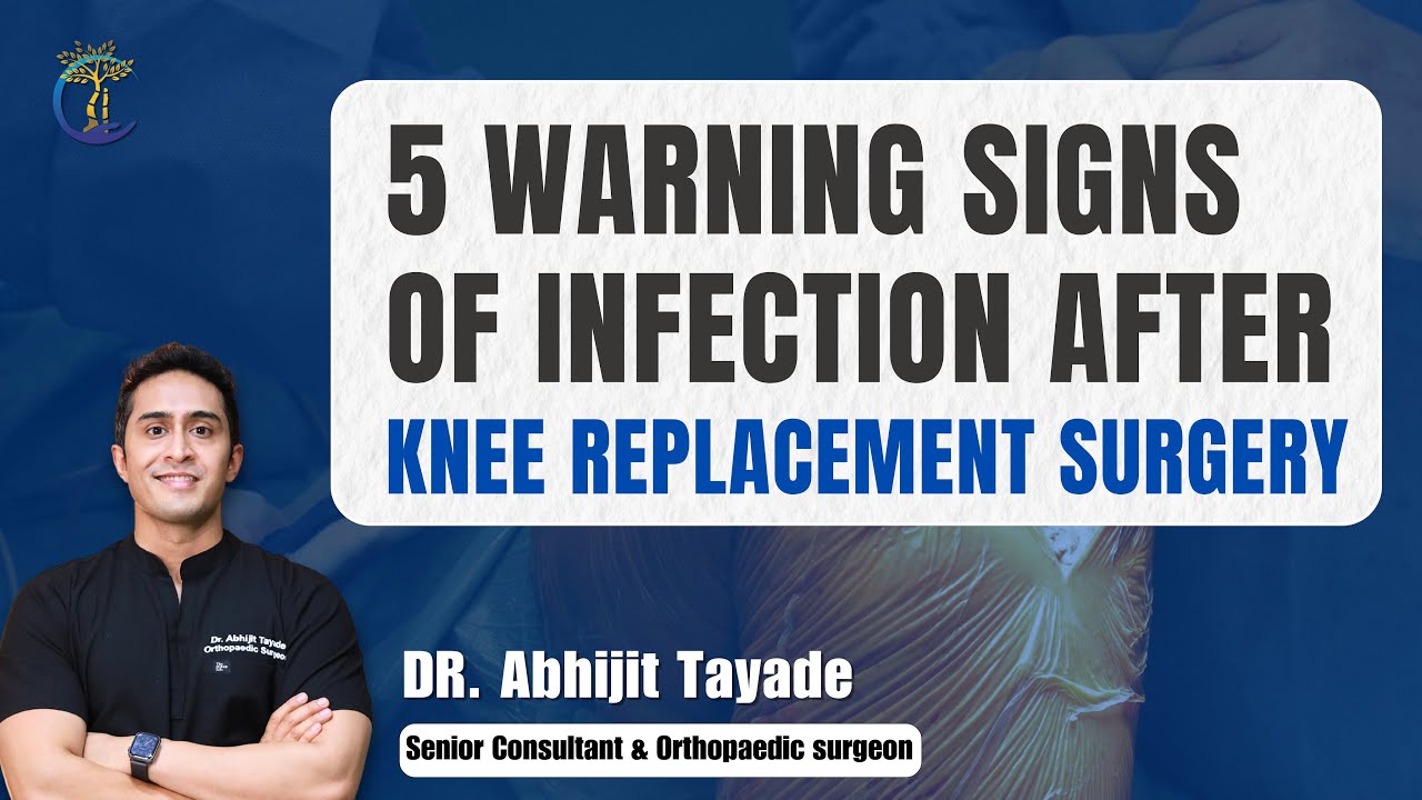 5 WARNING SIGNS of INFECTION After Knee Replacement Surgery | Dr. Abhijit Tayade | Delhi
