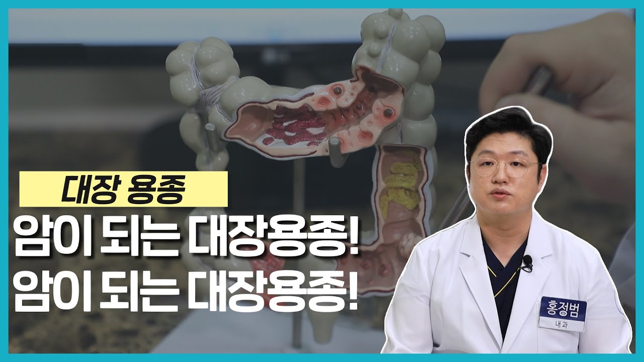 [건강365] 암이 되는 대장용종? (양산홍내과 / 홍정범 대표원장 / 055-912-1004)