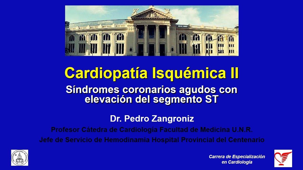 CARDIOPATIA ISQUEMICA II Sindromes Coronarios agudos CON elevacion del segmento ST