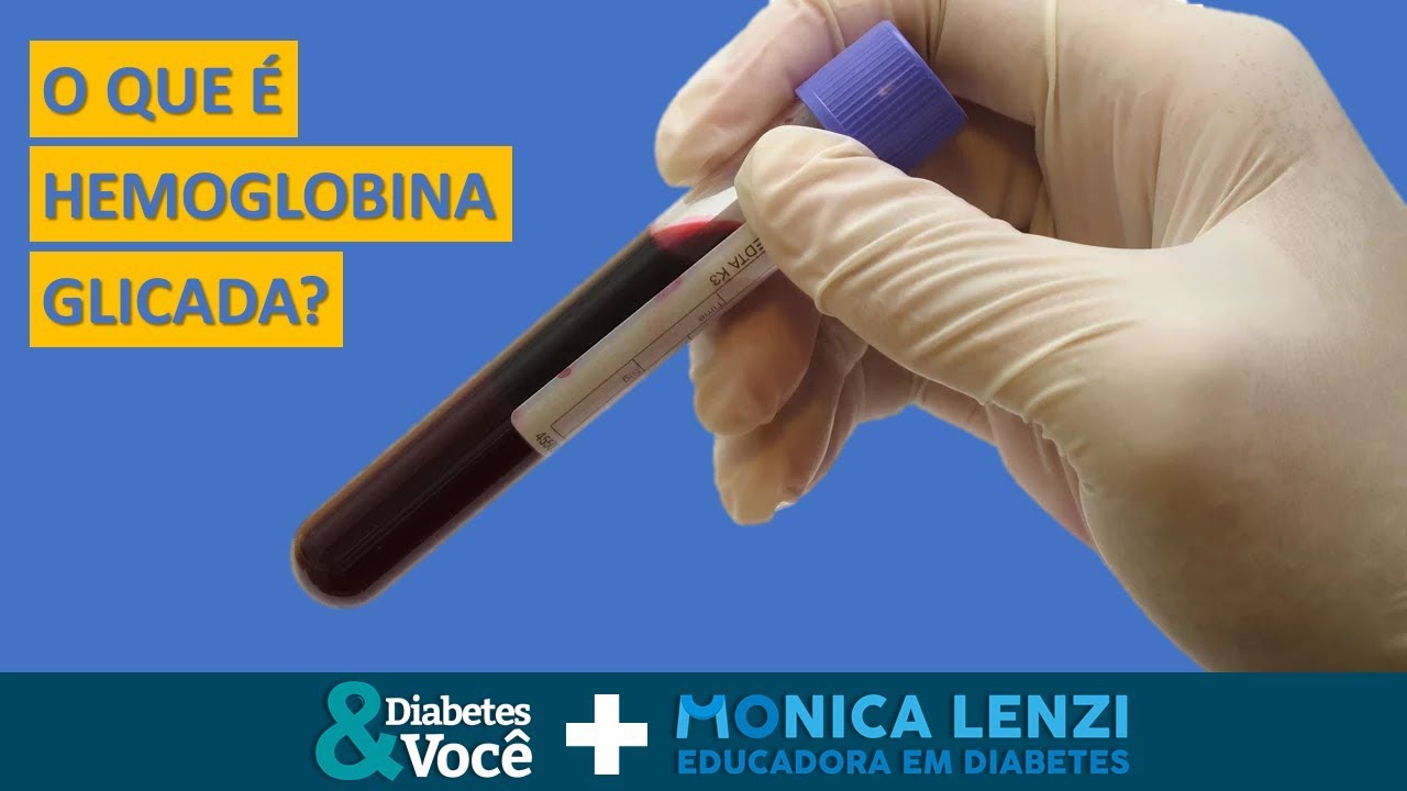 O que é hemoglobina glicada? | Diabetes & Você + Monica Lenzi