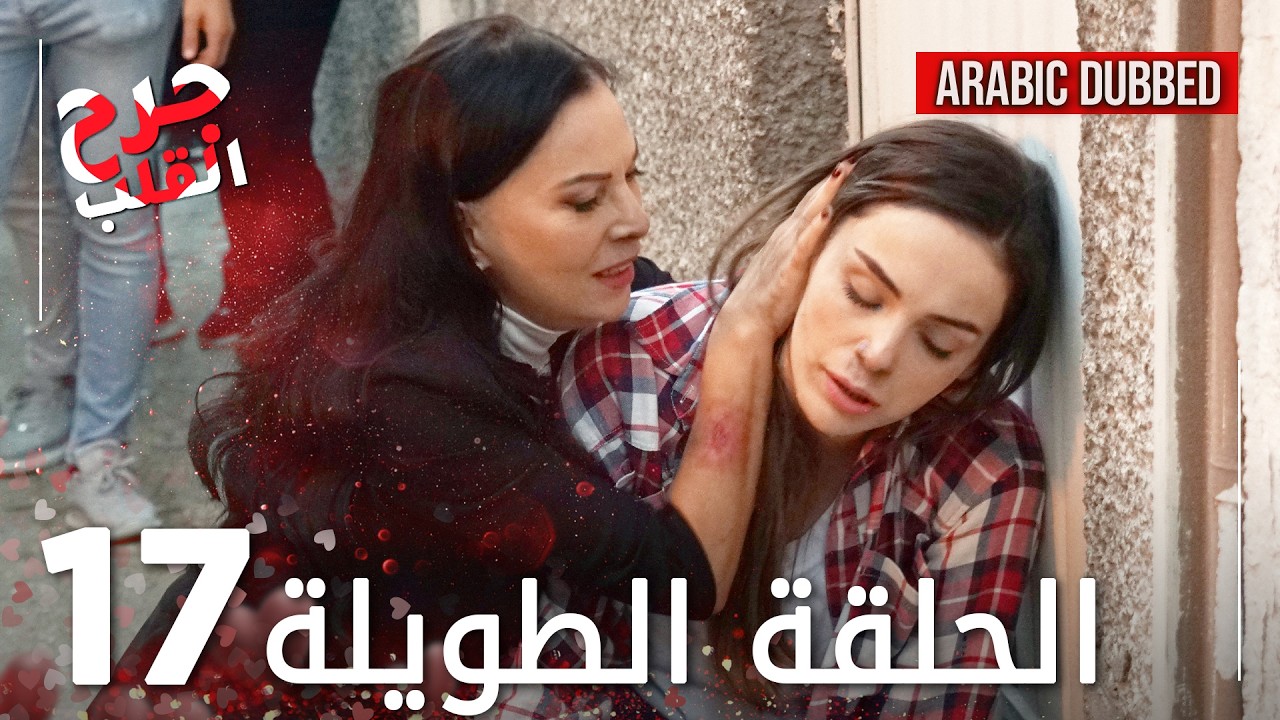 Kalp Yarası | جرح القلب | الحلقة 17 الطويلة | مدبلجة