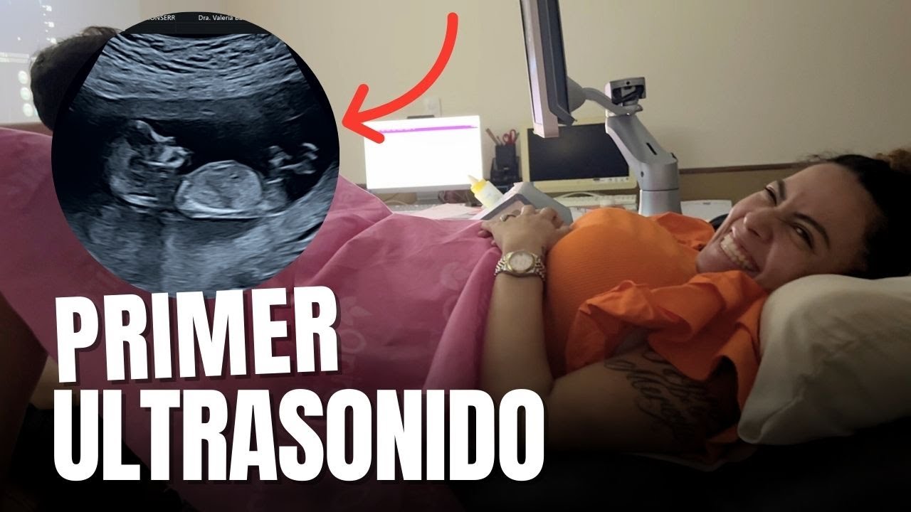 Escuchamos los latidos de bebe OMG🥹