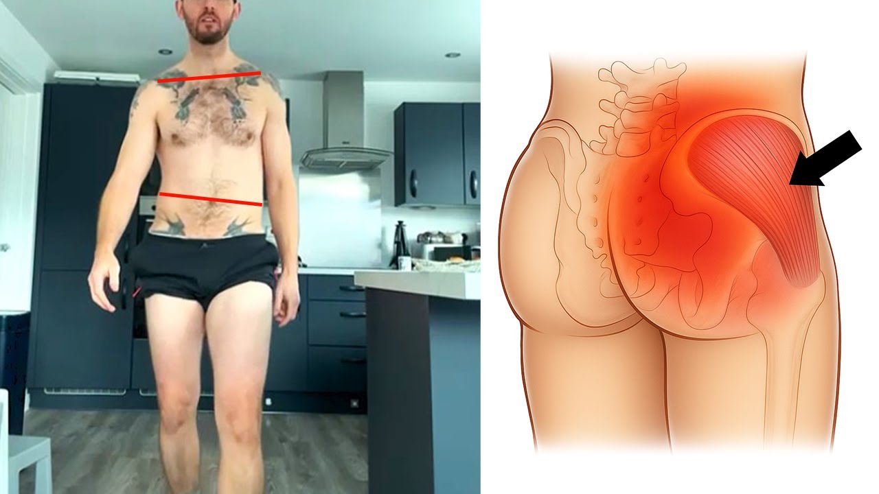 Right Pelvic Tilt & Glute Med Pain Fix  ( AIC pattern solution )