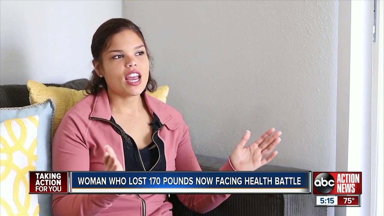 Florida woman now fighting cancer after dramatic weight loss