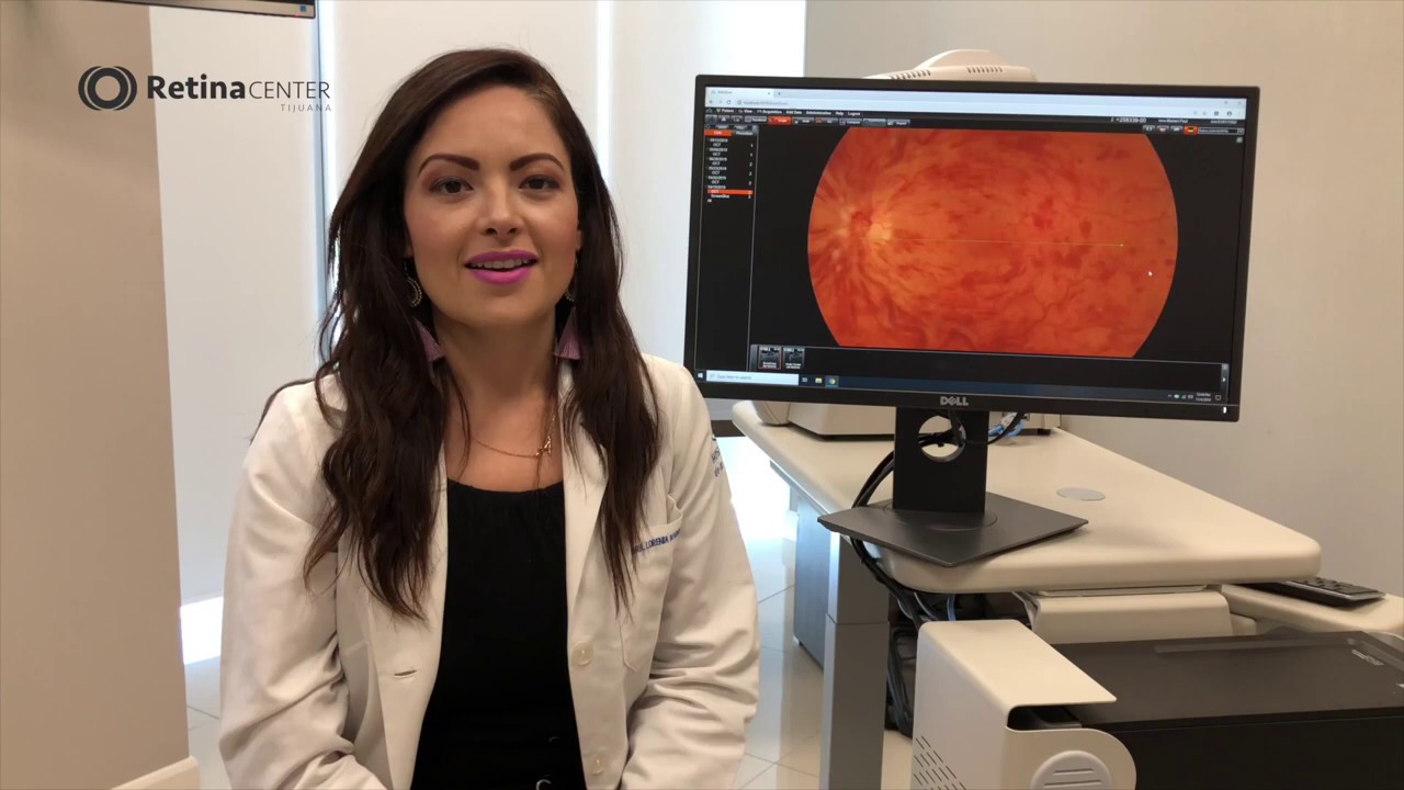 Oclusión de Vena de la Retina | Infarto en la Retina | Tijuana, Baja California, México