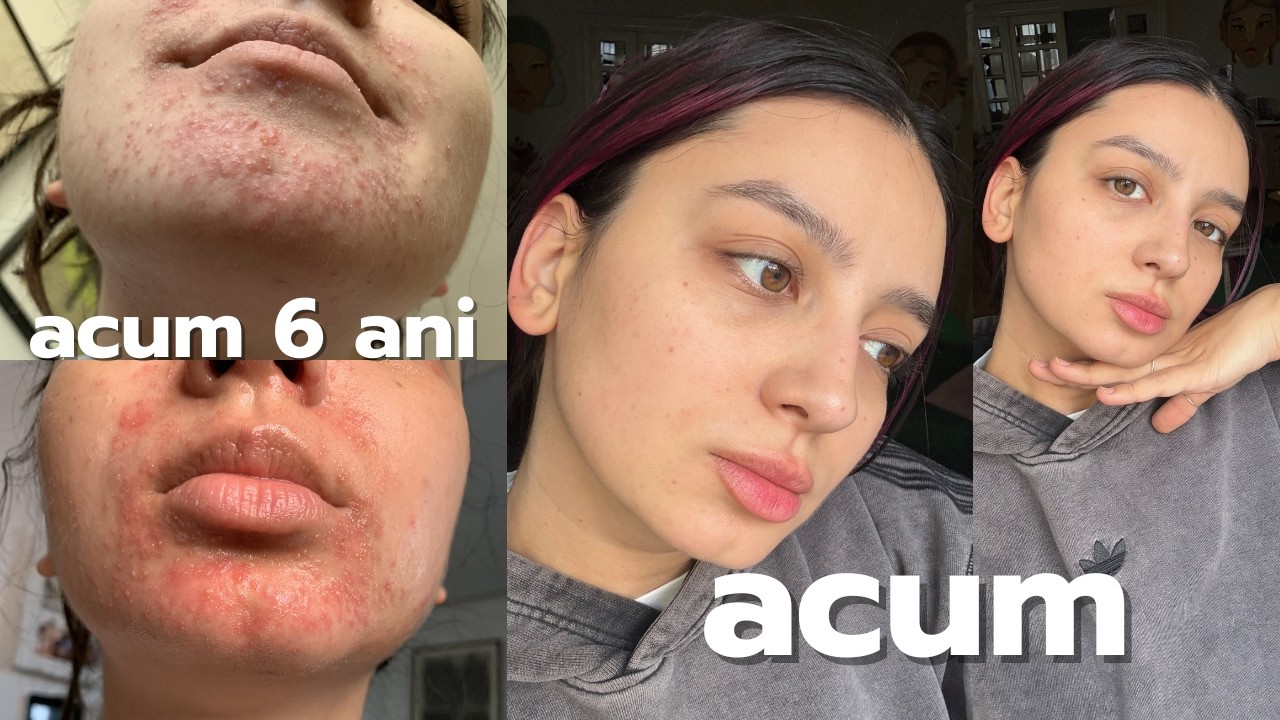 SKINCARE TALK - dermatita, skincare routine si gestionarea emotiilor cu Oana Rotariu