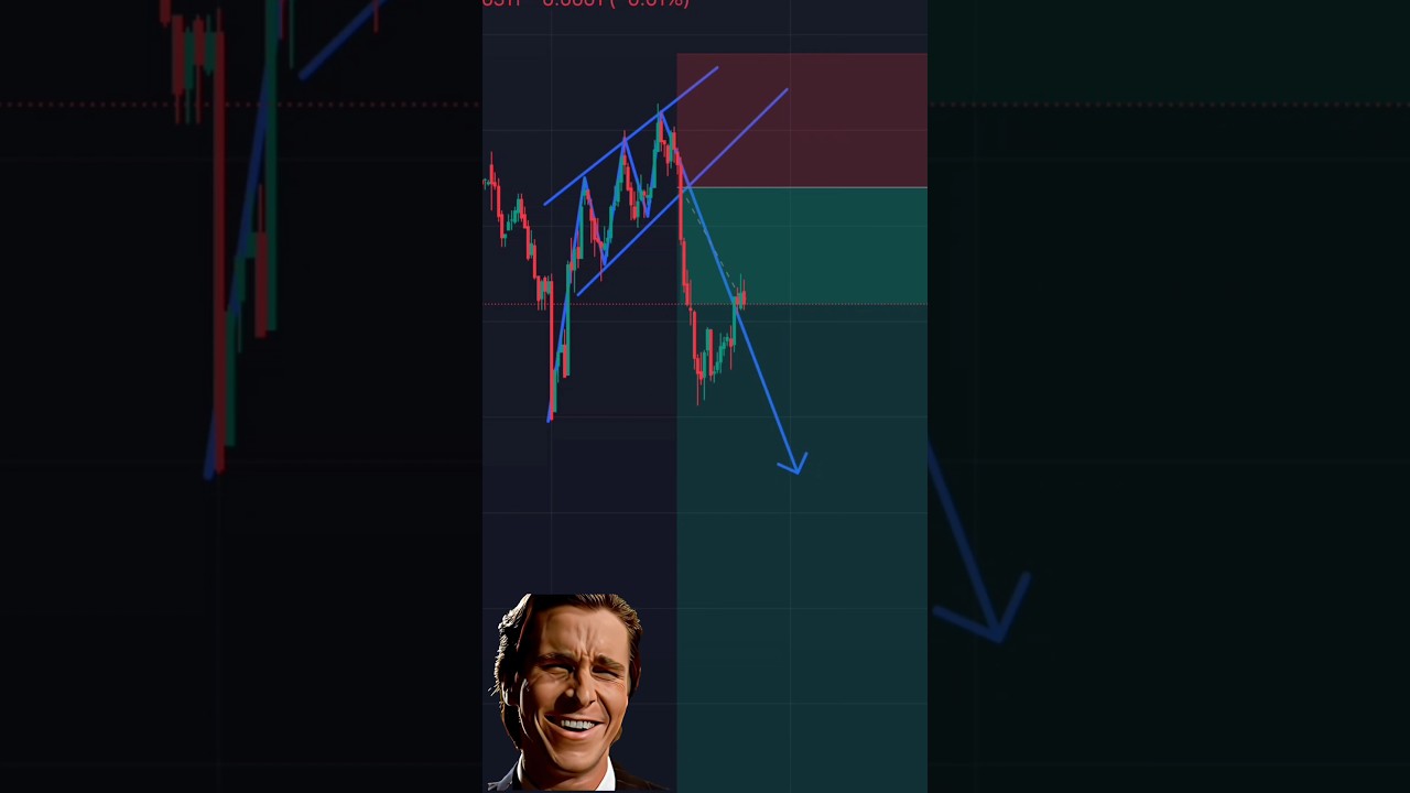 Olymp Trade Basics: Easy Strategy for Beginners! 📈💡 #OlympTrade #TradingTips #FinanceMadeSimple