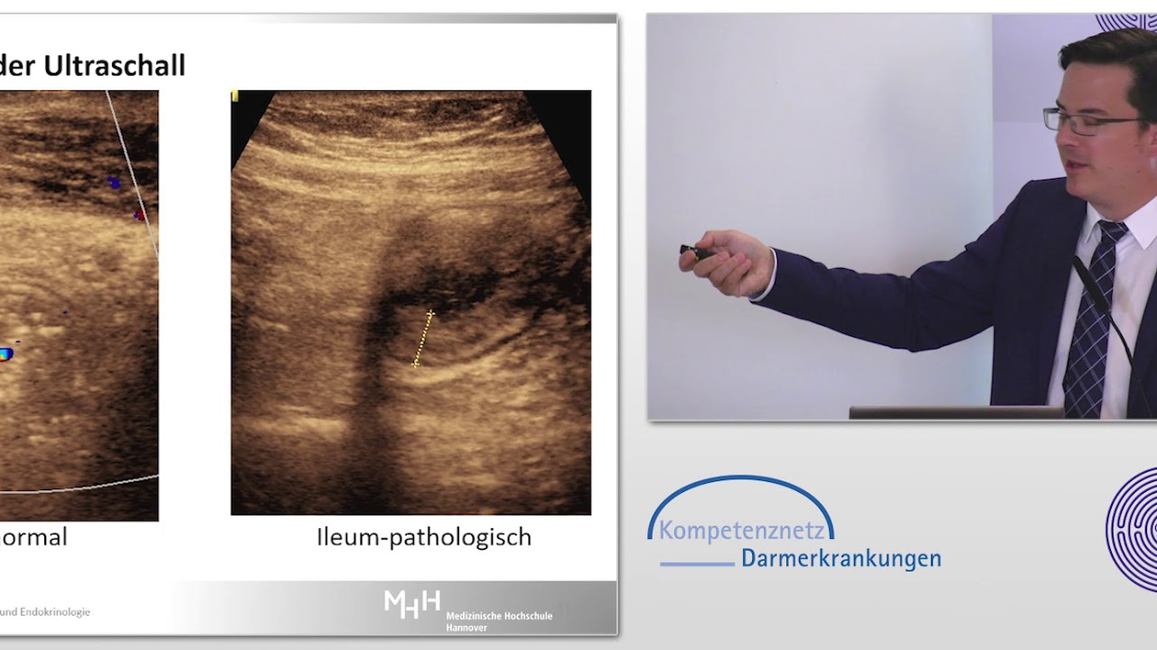Bildgebende Diagnostik und spezielle Marker bei CED