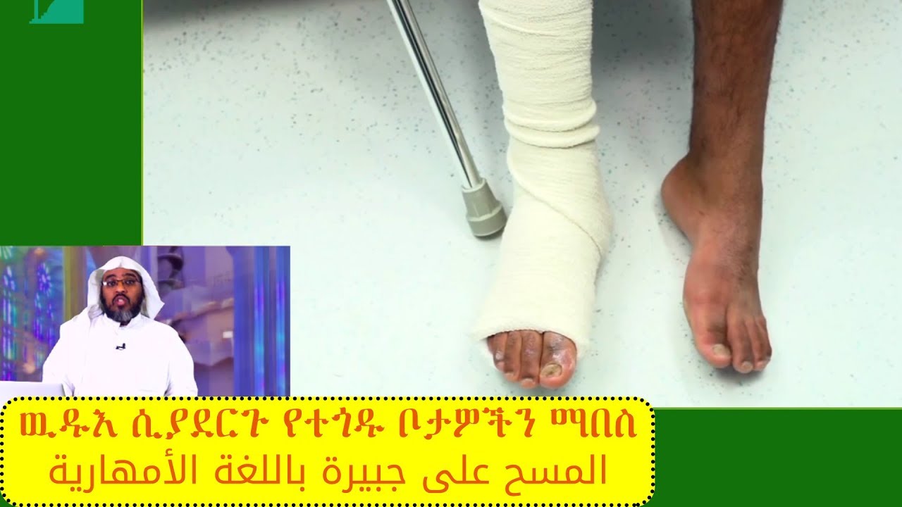 ዉዱእ ሲያደርጉ የተጎዱ ቦታዎችን ማበስ المسح على جبيرة باللغة الأمهارية