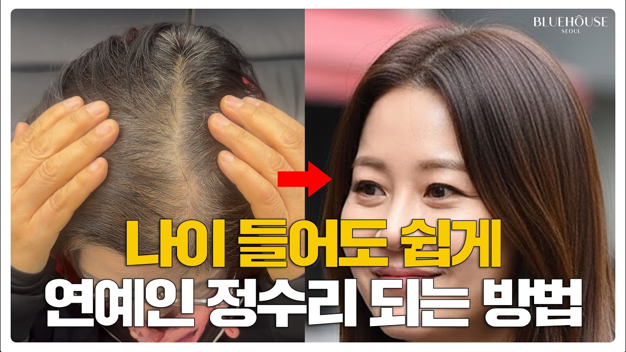 실패 없는 가르마 탈모 극복기
