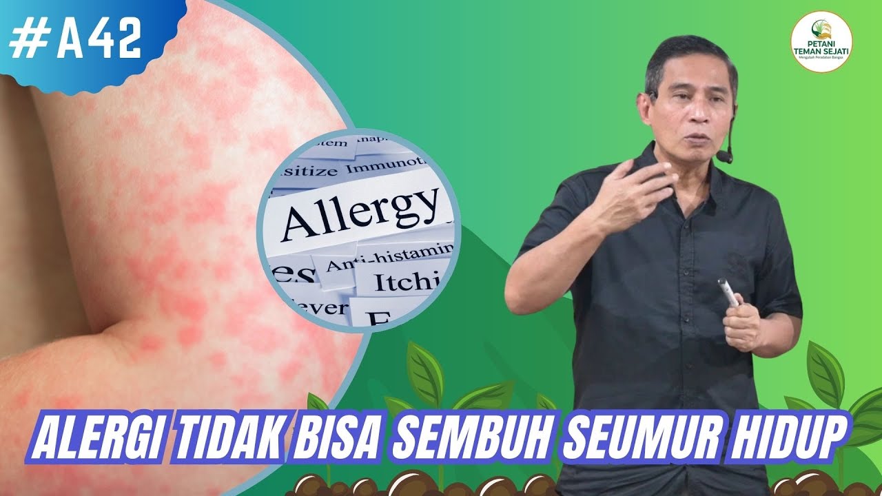 Alergi Itu Tidak Bisa Sembuh Seumur Hidup