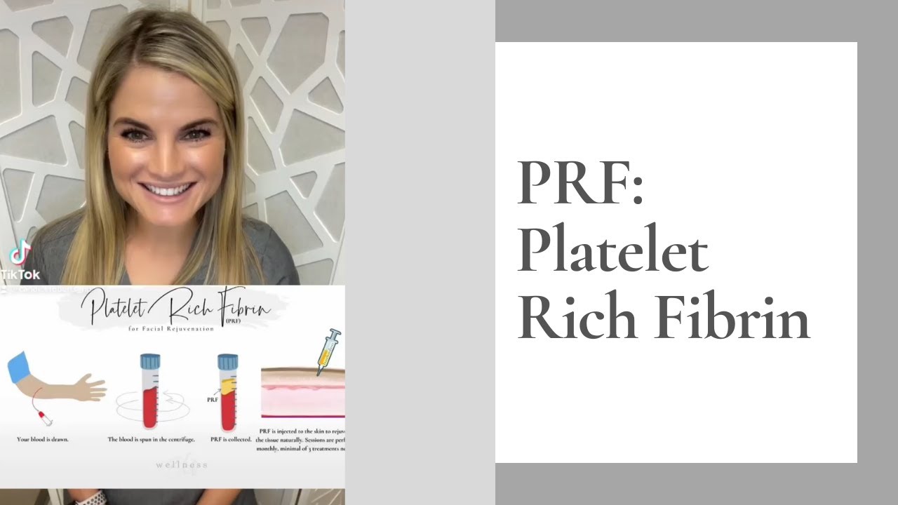 PRF - Platelet Rich Fibrin