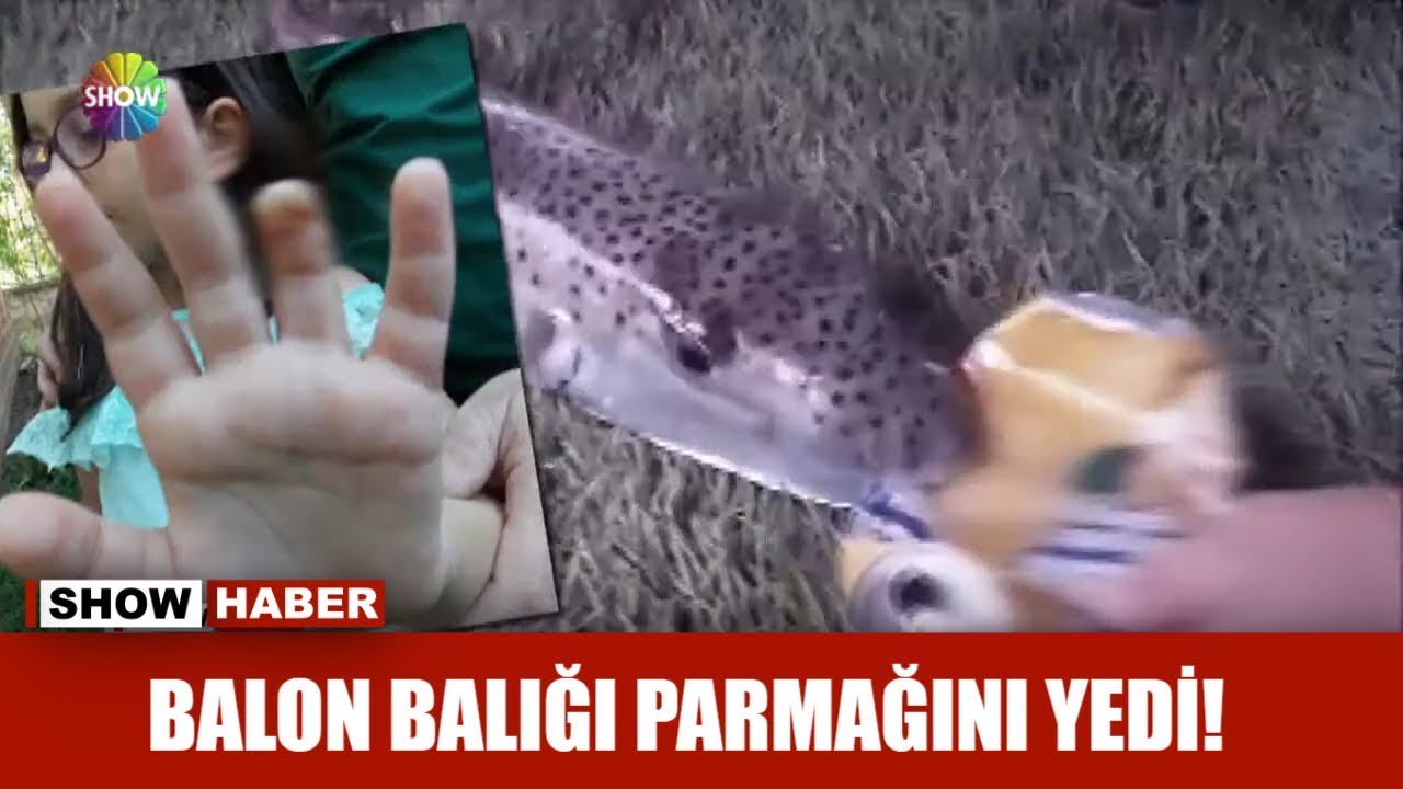 Balon balığı parmağını yedi!