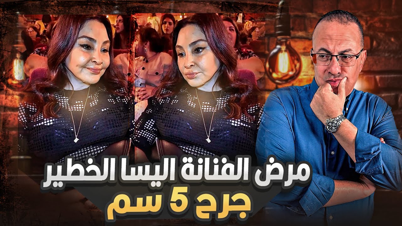 جرح 5 سم هو سبب فقدان صدرها . ماهو مرض الفنانه اليسا وكيف تحول شكلها فى اخر ظهور لها !!